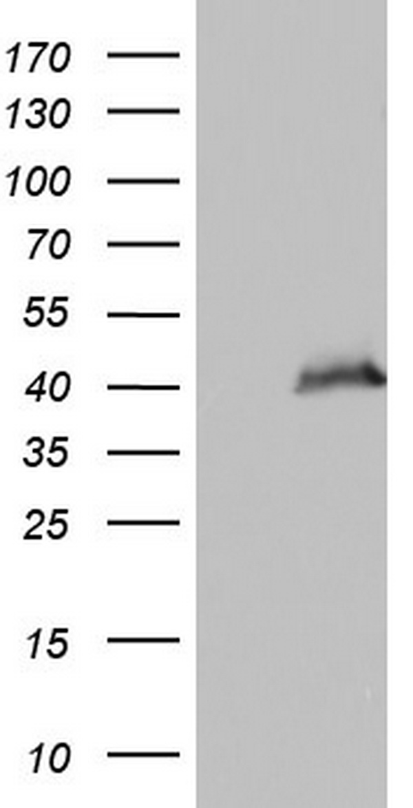 HEK293T cells were transfected with the pCMV6-ENTRY control (Left lane) or pCMV6-ENTRY PPP1R8 (Right lane) cDNA for 48 hrs and lysed. Equivalent amounts of cell lysates (5 ug per lane) were separated by SDS-PAGE and immunoblotted with anti-PPP1R8.