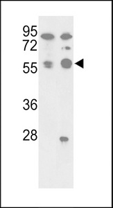 Western blot of hPPP5C-N61 in A375, A2058 cell line lysates (35 ug/lane). PPP5C (arrow) was detected using the purified antibody.