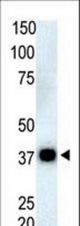 The anti-PPP6C antibody is used in Western blot to detect PPP6C in Thymus cell lysate.