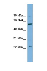 PPP5C antibody LS-C135395 Western blot of COL0205 Cell lysate. Antibody concentration 1 ug/ml.