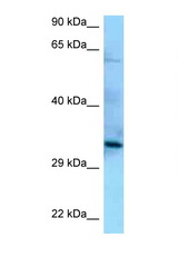 PPP6C antibody LS-C146227 Western blot of HepG2 Cell lysate. Antibody concentration 1 ug/ml.