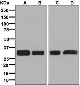Western blot analysis on (A) HeLa, (B) fetal thymus, (C) 293T, and (D) Jurkat cell lysates using anti-PPP6C antibody.