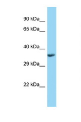 PPT1 antibody LS-C146114 Western blot of Fetal Kidney lysate. Antibody concentration 1 ug/ml.