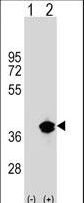 Western blot of PPT1 (arrow) using rabbit polyclonal PPT1 Antibody. 293 cell lysates (2 ug/lane) either nontransfected (Lane 1) or transiently transfected (Lane 2) with the PPT1 gene.