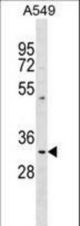PPT1 Antibody western blot of A549 cell line lysates (35 ug/lane). The PPT1 antibody detected the PPT1 protein (arrow).