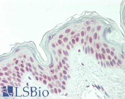 Human Skin: Formalin-Fixed, Paraffin-Embedded (FFPE)