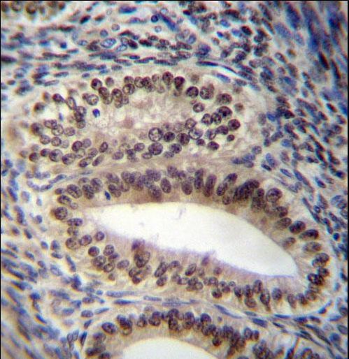 PGR/PR Antibody immunohistochemistry of formalin-fixed and paraffin-embedded human uterus tissue followed by peroxidase-conjugated secondary antibody and DAB staining.