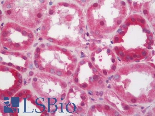 Human Kidney: Formalin-Fixed, Paraffin-Embedded (FFPE)