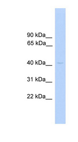 PRKAR1A antibody LS-C117130 Western blot of Fetal Liver lysate.