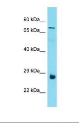 Western blot of Human Thyroid Tumor. C19orf55 antibody dilution 1.0 ug/ml.