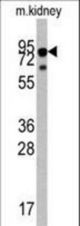 Western blot of anti-TRKA Antibody antibody in mouse liver tissue lysates (35 ug/lane). TRKA(arrow) was detected using the purified polyclonal antibody.