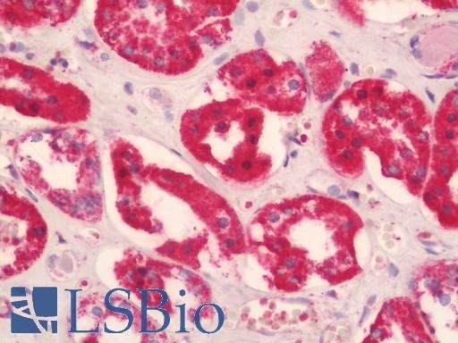 Human Kidney: Formalin-Fixed, Paraffin-Embedded (FFPE)