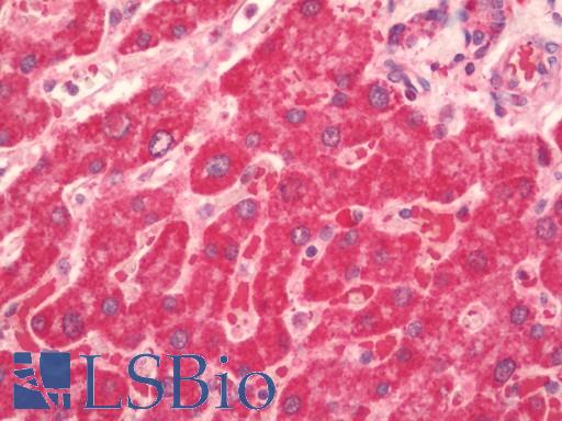 Human Liver: Formalin-Fixed, Paraffin-Embedded (FFPE)