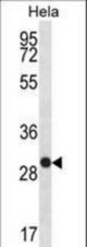 WFDC1 Antibody (C-term H163) western blot of HeLa cell line lysates (35 ug/lane). The WFDC1 antibody detected the WFDC1 protein (arrow).