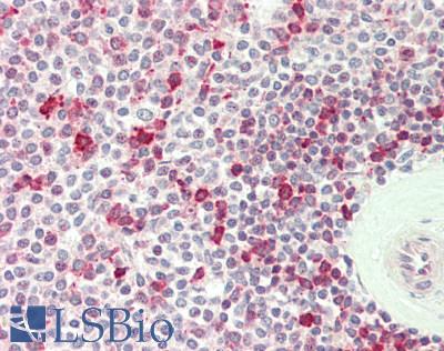 Human Spleen: Formalin-Fixed, Paraffin-Embedded (FFPE)