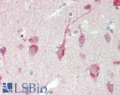 Human Brain, Cortex: Formalin-Fixed, Paraffin-Embedded (FFPE)