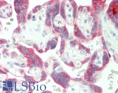 Human Placenta: Formalin-Fixed, Paraffin-Embedded (FFPE)