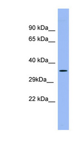 PSG5 antibody western blot of Human Fetal Spleen lysate.