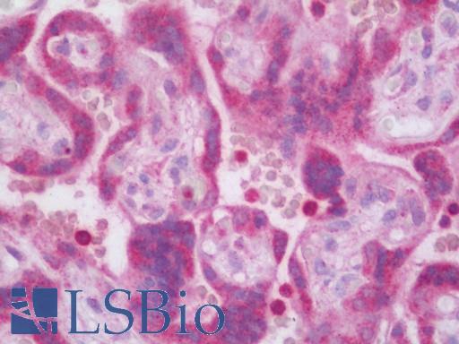 Human Placenta: Formalin-Fixed, Paraffin-Embedded (FFPE)