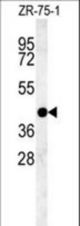 PSG9 Antibody western blot of ZR-75-1 cell line lysates (35 ug/lane). The PSG9 antibody detected the PSG9 protein (arrow).