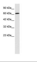 Jurkat Cell Lysate