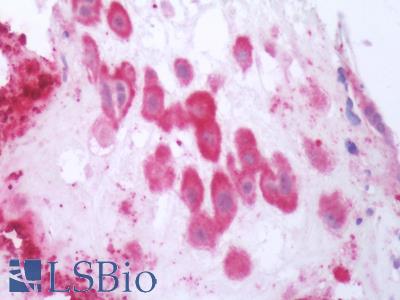 Human Placenta: Formalin-Fixed, Paraffin-Embedded (FFPE)