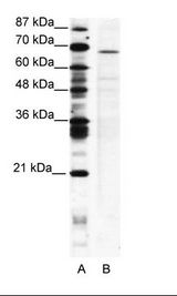 A: Marker, B: Jurkat Cell Lysate