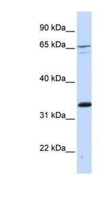 PSIP1 antibody LS-C109946 Western blot of 721_B cell lysate.