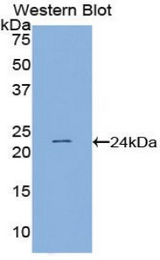 Western blot of recombinant PSIP1 / LEDGF / p75.