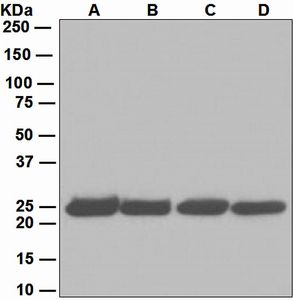 Western blot analysis on (A) Jurkat, (B) 293T, (C) HeLa, and (D) JAR cell lysates using anti-PSMA2 antibody.