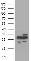 HEK293T cells were transfected with the pCMV6-ENTRY control (Left lane) or pCMV6-ENTRY PSMA2 (Right lane) cDNA for 48 hrs and lysed. Equivalent amounts of cell lysates (5 ug per lane) were separated by SDS-PAGE and immunoblotted with anti-PSMA2.