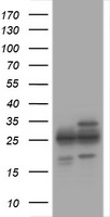 HEK293T cells were transfected with the pCMV6-ENTRY control (Left lane) or pCMV6-ENTRY PSMA2 (Right lane) cDNA for 48 hrs and lysed. Equivalent amounts of cell lysates (5 ug per lane) were separated by SDS-PAGE and immunoblotted with anti-PSMA2.