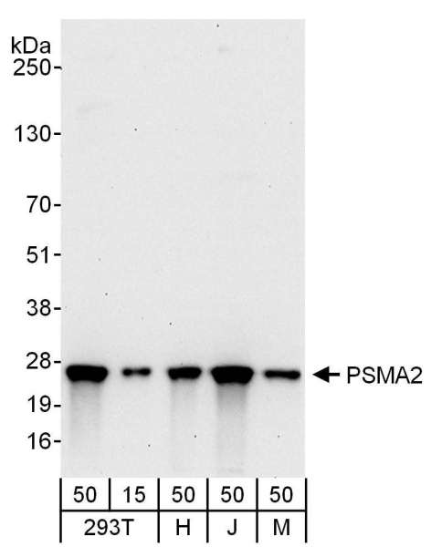 Detection of Human and Mouse PSMA2 by Western Blot. Samples: Whole cell lysate from 293T (15 and 50 ug), HeLa (H; 50 ug), Jurkat (J; 50 ug) and mouse NIH3T3 (M; 50 ug) cells. Antibodies: Affinity purified rabbit anti-PSMA2 antibody used for WB at 0.1 ug/ml. Detection: Chemiluminescence with an exposure time of 30 seconds.