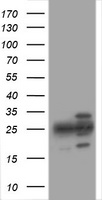 HEK293T cells were transfected with the pCMV6-ENTRY control (Left lane) or pCMV6-ENTRY PSMA2 (Right lane) cDNA for 48 hrs and lysed. Equivalent amounts of cell lysates (5 ug per lane) were separated by SDS-PAGE and immunoblotted with anti-PSMA2.
