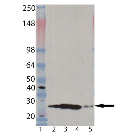 Western blot of Proteasome 20S alpha 2 subunit monoclonal antibody (MCP21): Lane 1: MW marker, Lane 2: HeLa (heat shocked), Lane 3: Jurkat, Lane 4: HeLa S100 fraction, Lane 5: Proteasome 26S (human), (purified).