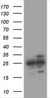 HEK293T cells were transfected with the pCMV6-ENTRY control (Left lane) or pCMV6-ENTRY PSMA2 (Right lane) cDNA for 48 hrs and lysed. Equivalent amounts of cell lysates (5 ug per lane) were separated by SDS-PAGE and immunoblotted with anti-PSMA2.