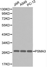 Western blot of PSMA3 pAb in extracts from JAR, A549 and PC12 cells.