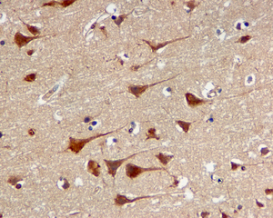 IHC of paraffin-embedded human brain tissue using anti-PSMA3 antibody.