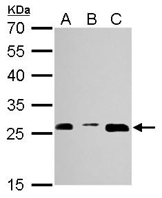 Proteasome 20S alpha 3 antibody detects PSMA3 protein by Western blot analysis. A. 30 ug NIH-3T3 whole cell lysate/extract. B. 30 ug JC whole cell lysate/extract. C. 30 ug BCL-1 whole cell lysate/extract. 12 % SDS-PAGE. Proteasome 20S alpha 3 antibody dilution:1:1000.