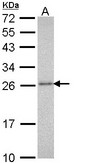 Sample (30 ug of whole cell lysate). A: Molt-4 . 12% SDS PAGE. HC8 / PSMA3 antibody diluted at 1:1000.