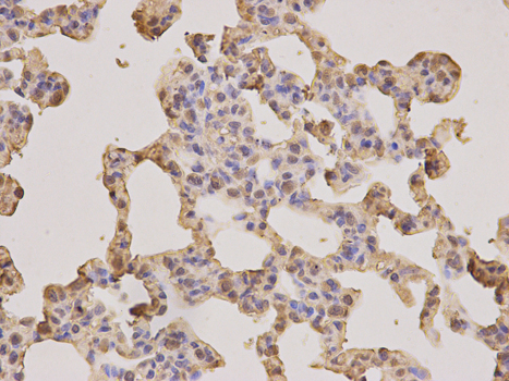 Immunohistochemistry of paraffin-embedded rat lung using PSMA3 antibody at dilution of 1:200 (400x lens).
