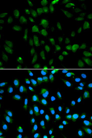 Immunofluorescence analysis of MCF7 cell using PSMA3 antibody. Blue: DAPI for nuclear staining.