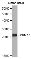 Western blot of extracts of human brain cell lines, using PSMA6 antibody.