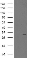 HEK293T cells were transfected with the pCMV6-ENTRY control (Left lane) or pCMV6-ENTRY PSMA6 (Right lane) cDNA for 48 hrs and lysed. Equivalent amounts of cell lysates (5 ug per lane) were separated by SDS-PAGE and immunoblotted with anti-PSMA6.