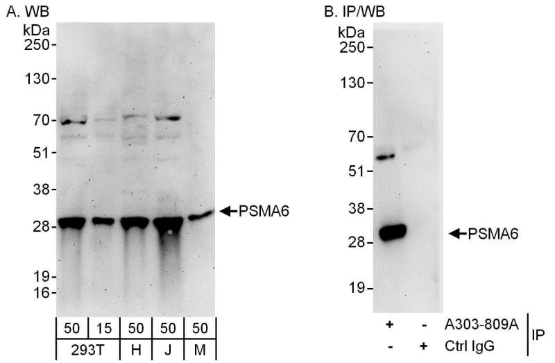 Detection of Human and Mouse PSMA6 by Western Blot (h and m) and Immunoprecipitation (h). Samples: Whole cell lysate from 293T (15 and 50 ug for WB; 1 mg for IP, 20% of IP loaded), HeLa (H; 50 ug), Jurkat (J; 50 ug) and mouse NIH3T3 (M; 50 ug) cells. Antibodies: Affinity purified rabbit anti-PSMA6 antibody used for WB at 0.1 ug/ml (A) and 1 ug/ml (B) and used for IP at 6 ug/mg lysate. Detection: Chemiluminescence with exposure times of 3 minutes (A) and 30 seconds (B).