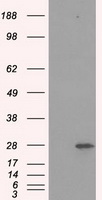 HEK293T cells were transfected with the pCMV6-ENTRY control (Left lane) or pCMV6-ENTRY PSMA7 (Right lane) cDNA for 48 hrs and lysed. Equivalent amounts of cell lysates (5 ug per lane) were separated by SDS-PAGE and immunoblotted with anti-PSMA7.