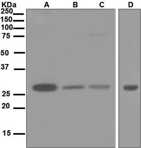 Western blot analysis on (A) A549, (B) MCF-7, (C) 293T, and (D) HeLa cell lysates using anti-PSMA7 antibody.