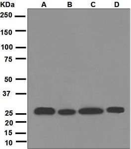 Western blot analysis on (A) MCF-7, (B) HeLa, (C) HepG2, and (D) A549 cell lysates using anti-PSMA7 antibody.