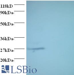 Western blot of Proteasome subunit alpha type-7 antibody at 2 ug/ml. Lane 1:293T whole cell lysate. Lane 2: EC109whole cell lysate. Secondary: Goat polyclonal to Rabbit IgG at 1:15000 dilution. Predicted band size: 27 kDa. Observed band size: 27 kDa.