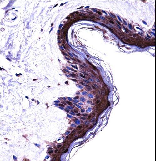 PSMB5 Antibody immunohistochemistry of formalin-fixed and paraffin-embedded human skin tissue followed by peroxidase-conjugated secondary antibody and DAB staining.